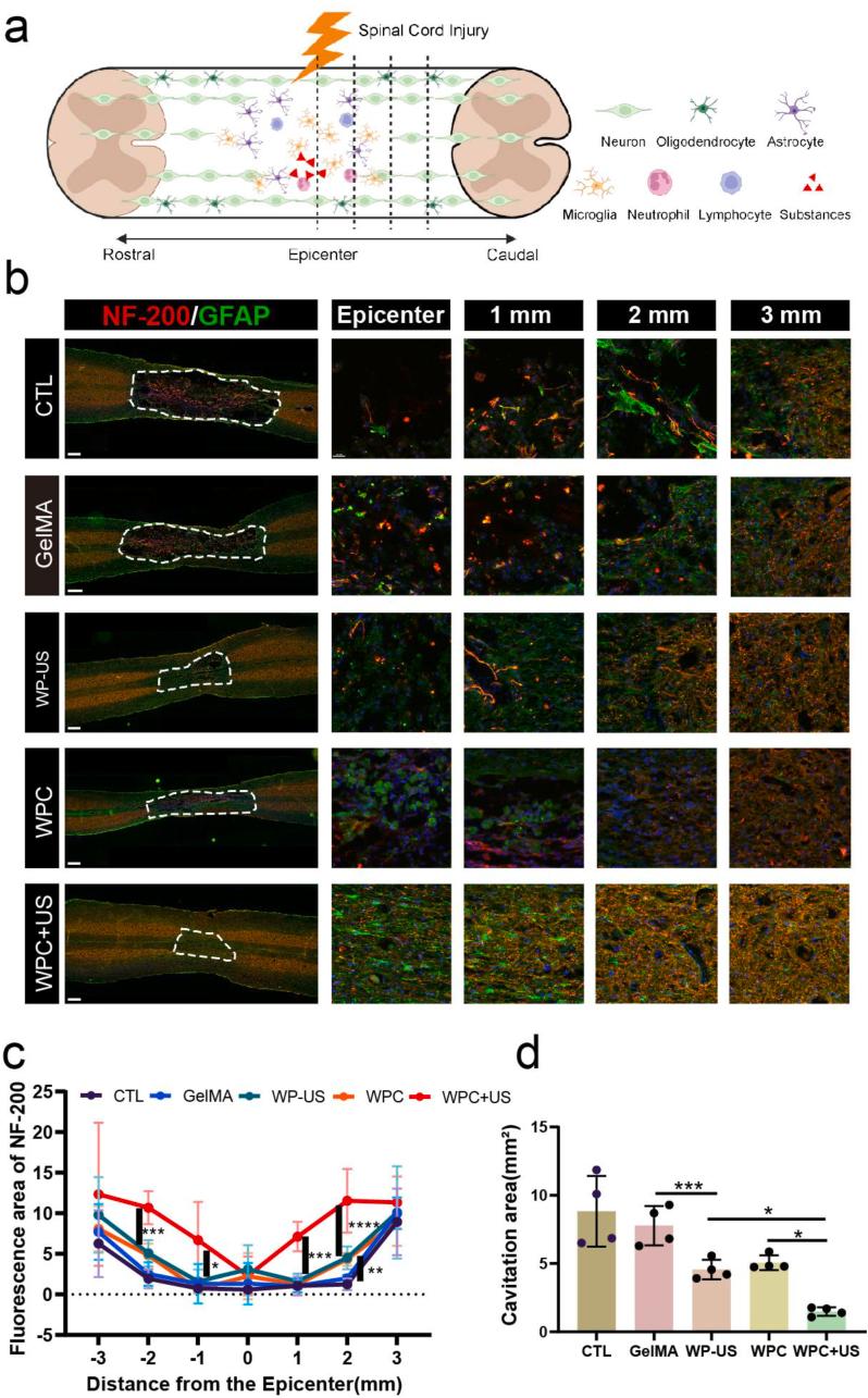 https://cdn.ncbi.nlm.nih.gov/pmc/blobs/5e97/12088769/26d67a30a113/gr11.jpg