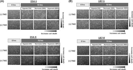 https://cdn.ncbi.nlm.nih.gov/pmc/blobs/5e97/3434886/0ab226dbd465/11060_2012_923_Fig2_HTML.jpg