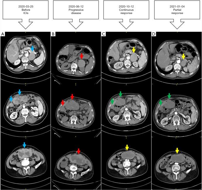 https://cdn.ncbi.nlm.nih.gov/pmc/blobs/5e99/10727817/0030c2b54d10/hbsn-12-06-882-f4.jpg
