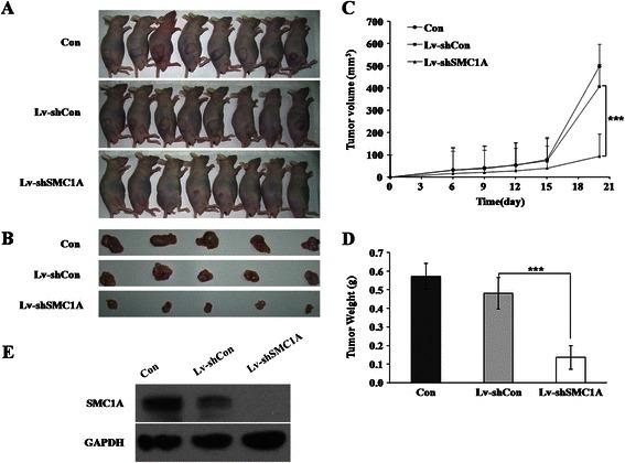 https://cdn.ncbi.nlm.nih.gov/pmc/blobs/5e9a/4352287/8186b3993956/12885_2015_1085_Fig3_HTML.jpg