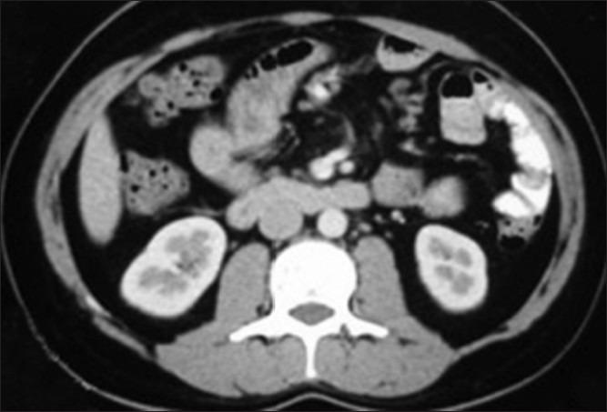 https://cdn.ncbi.nlm.nih.gov/pmc/blobs/5e9b/3835975/f5f8951c67d2/UA-5-223-g001.jpg