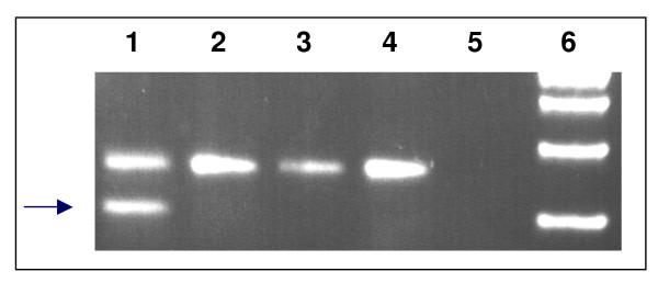 https://cdn.ncbi.nlm.nih.gov/pmc/blobs/5e9e/1343542/9f78d95b8a00/1471-2350-7-1-1.jpg
