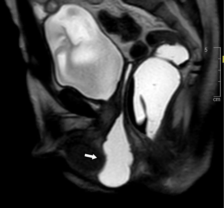 https://cdn.ncbi.nlm.nih.gov/pmc/blobs/5e9f/10251104/16d13e85f38f/tau-12-05-932-f6.jpg