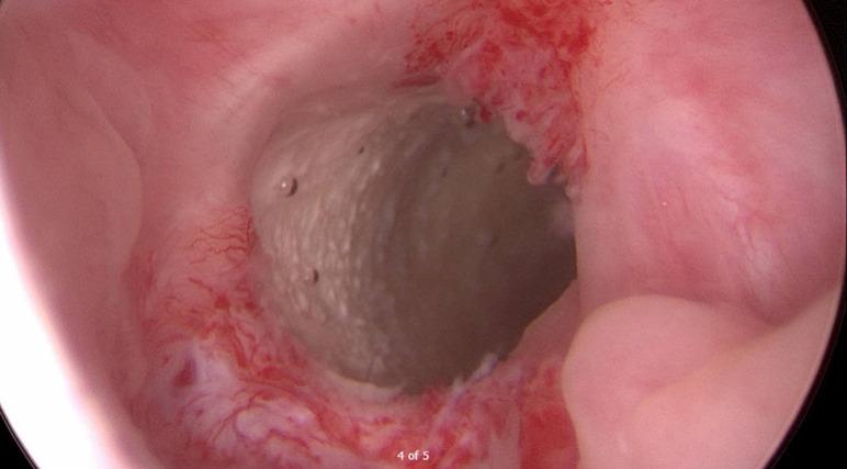 https://cdn.ncbi.nlm.nih.gov/pmc/blobs/5e9f/10251104/6ed2f54adb58/tau-12-05-932-f3.jpg
