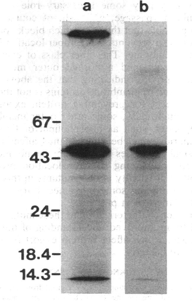 https://cdn.ncbi.nlm.nih.gov/pmc/blobs/5eab/217474/720b278a9117/jbacter00245-0427-a.jpg
