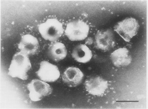 https://cdn.ncbi.nlm.nih.gov/pmc/blobs/5eab/516003/3aa0989a1b05/jvirol00216-0116-a.jpg
