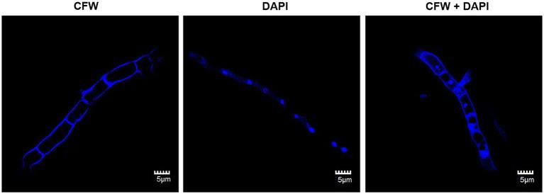 https://cdn.ncbi.nlm.nih.gov/pmc/blobs/5eab/8417879/310b2d276cb9/fmicb-12-734780-g001.jpg