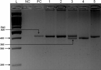 https://cdn.ncbi.nlm.nih.gov/pmc/blobs/5eb0/2805420/4416dc0b03d0/mv-v16-18-f1.jpg
