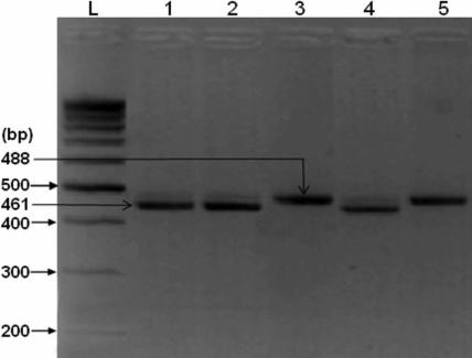 https://cdn.ncbi.nlm.nih.gov/pmc/blobs/5eb0/2805420/61e06450e83a/mv-v16-18-f2.jpg