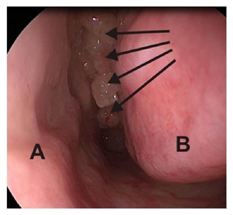https://cdn.ncbi.nlm.nih.gov/pmc/blobs/5eb0/5700512/02b5ee3160c0/BMRI2017-9195163.001.jpg