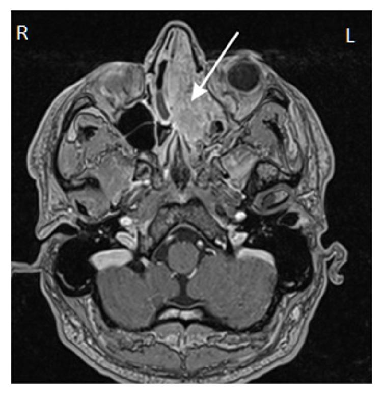 https://cdn.ncbi.nlm.nih.gov/pmc/blobs/5eb0/5700512/a57d9ff52a36/BMRI2017-9195163.003.jpg