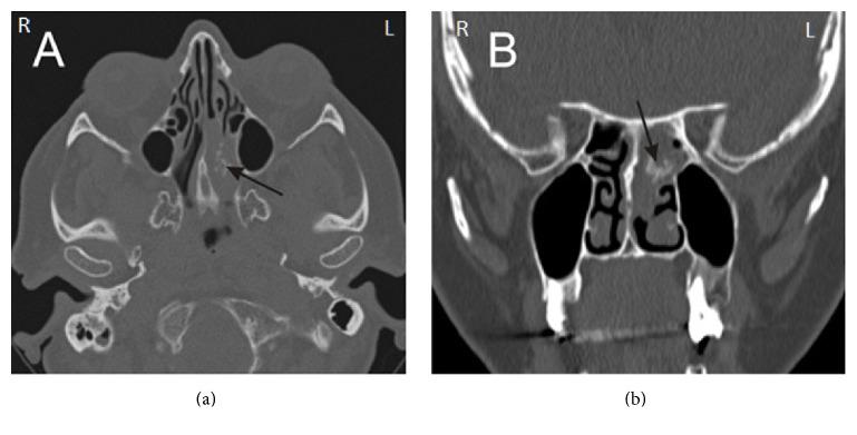 https://cdn.ncbi.nlm.nih.gov/pmc/blobs/5eb0/5700512/b30cb950e847/BMRI2017-9195163.002.jpg