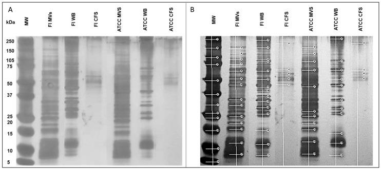 https://cdn.ncbi.nlm.nih.gov/pmc/blobs/5eb5/12196092/6651d1d0196d/microorganisms-13-01341-g002.jpg