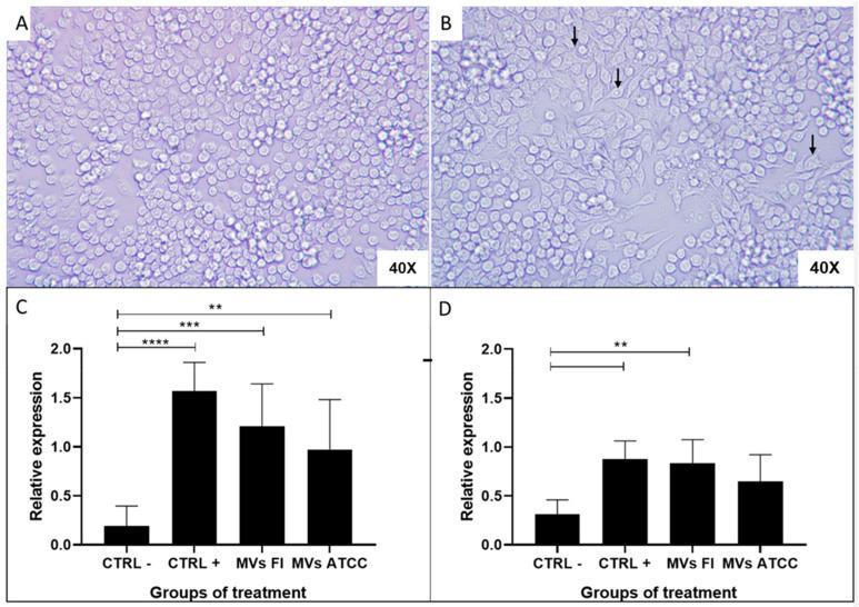 https://cdn.ncbi.nlm.nih.gov/pmc/blobs/5eb5/12196092/9b117fce2c43/microorganisms-13-01341-g006.jpg
