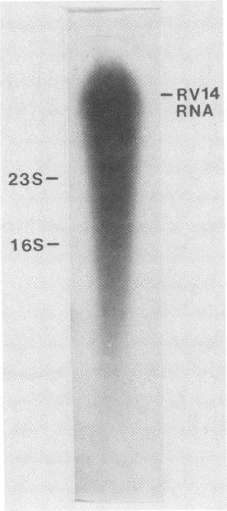 https://cdn.ncbi.nlm.nih.gov/pmc/blobs/5eb5/252623/ea3a54b32920/jvirol00116-0298-a.jpg