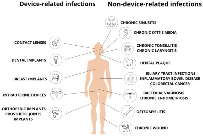https://cdn.ncbi.nlm.nih.gov/pmc/blobs/5eb6/11641729/c77d1b9273f2/ijms-25-12808-g002.jpg