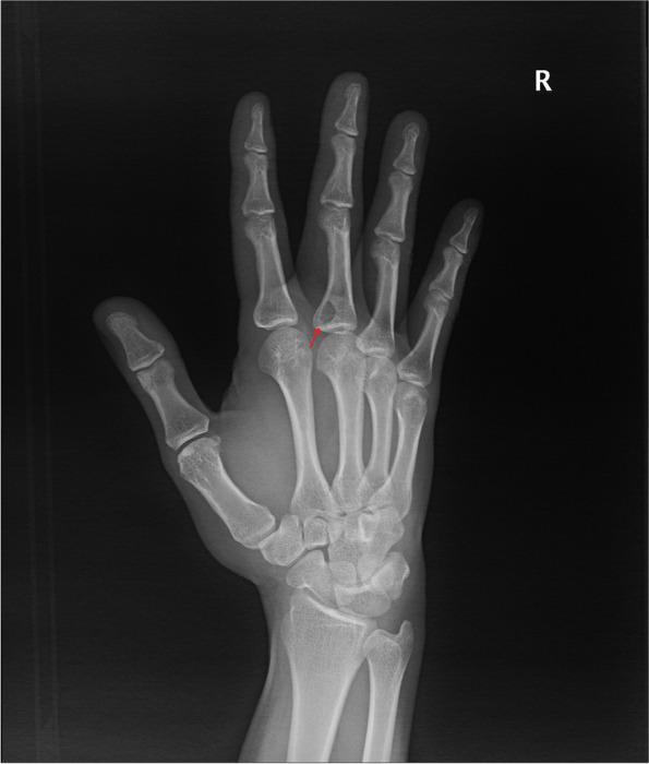 https://cdn.ncbi.nlm.nih.gov/pmc/blobs/5eb7/8650527/3e509796bb0c/12957_2021_2454_Fig3_HTML.jpg