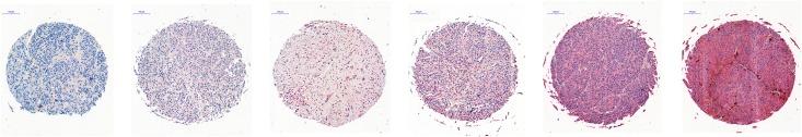 https://cdn.ncbi.nlm.nih.gov/pmc/blobs/5ec0/6224082/b73fda914c4a/pone.0207019.g001.jpg