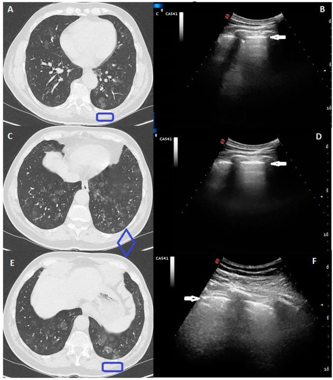 https://cdn.ncbi.nlm.nih.gov/pmc/blobs/5ec1/8001137/bcb43c27ed7b/medicina-57-00236-g001.jpg