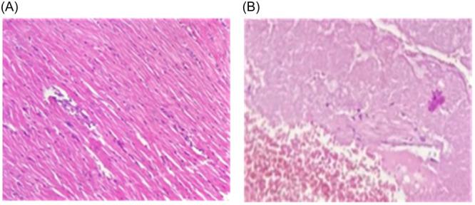https://cdn.ncbi.nlm.nih.gov/pmc/blobs/5ec5/11232052/2e546b0c831f/HSR2-7-e2228-g006.jpg