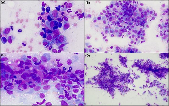 https://cdn.ncbi.nlm.nih.gov/pmc/blobs/5ec5/12324153/80b3924b702e/VCP-54-S29-g002.jpg