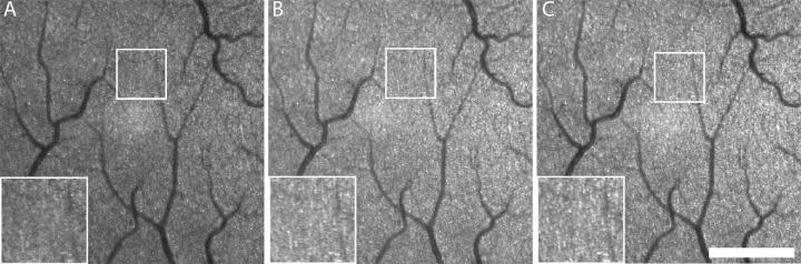 https://cdn.ncbi.nlm.nih.gov/pmc/blobs/5ec6/9123519/cabfc8e6e041/tvst-11-5-19-f002.jpg