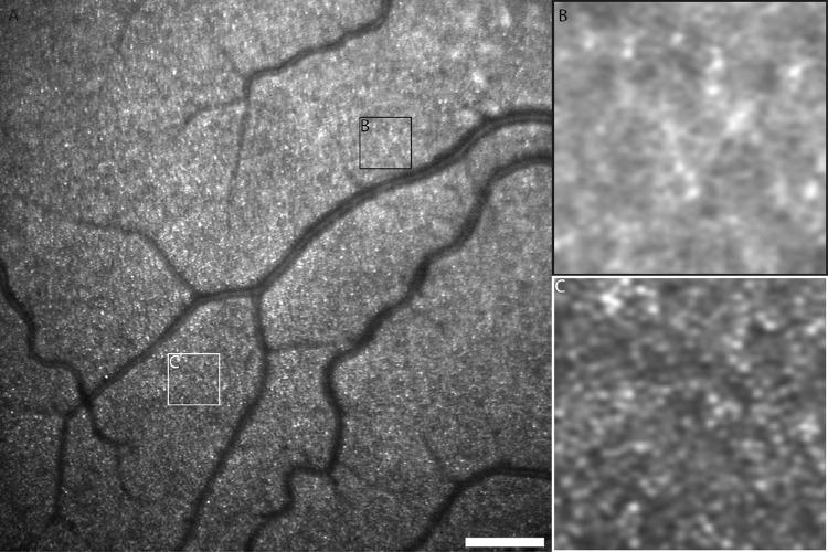 https://cdn.ncbi.nlm.nih.gov/pmc/blobs/5ec6/9123519/f4f82bdb339c/tvst-11-5-19-f003.jpg