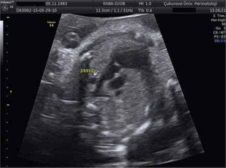 https://cdn.ncbi.nlm.nih.gov/pmc/blobs/5ec7/6463432/f9334a6262fe/TJOG-16-23-g1.jpg