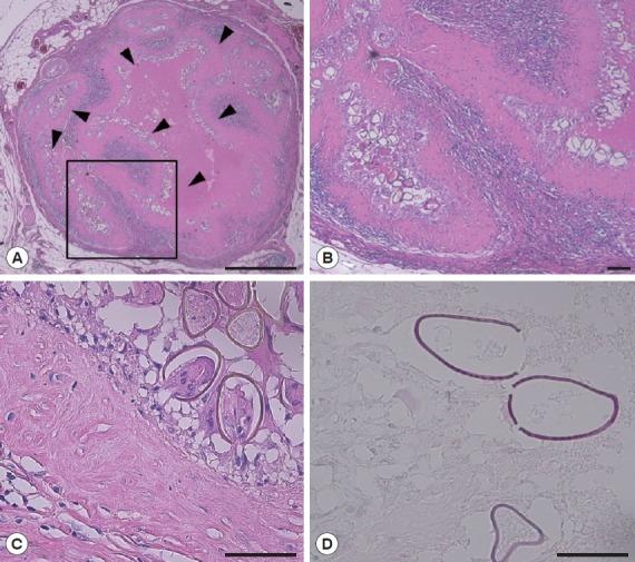 https://cdn.ncbi.nlm.nih.gov/pmc/blobs/5ec8/5523897/235cce827f19/kjp-55-3-313f2.jpg