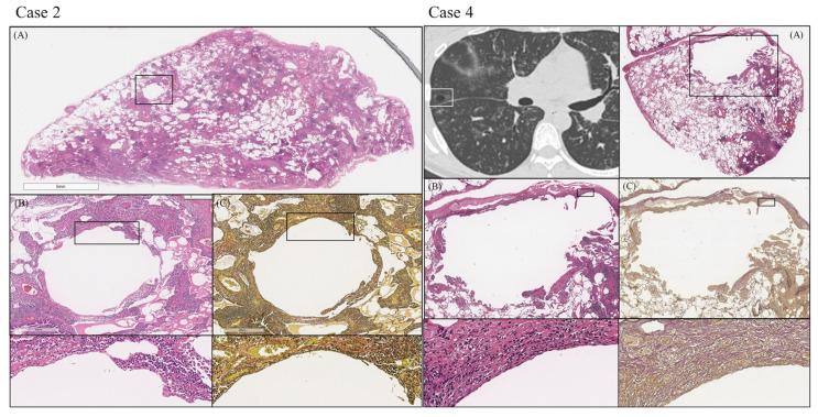 https://cdn.ncbi.nlm.nih.gov/pmc/blobs/5ec9/10135672/228ee14c7fb0/arm-91-00014-g003.jpg
