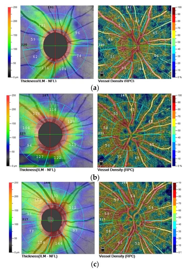 https://cdn.ncbi.nlm.nih.gov/pmc/blobs/5eca/8472507/09855e848d68/jcm-10-04131-g001.jpg