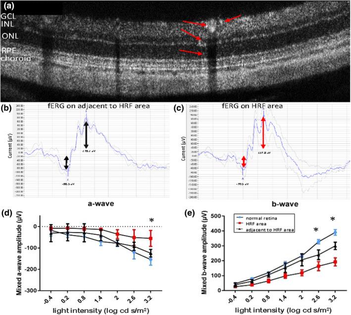https://cdn.ncbi.nlm.nih.gov/pmc/blobs/5ed5/10485584/247355922427/JOA-243-697-g001.jpg
