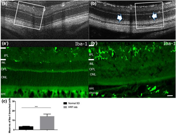 https://cdn.ncbi.nlm.nih.gov/pmc/blobs/5ed5/10485584/ca1ce14eac93/JOA-243-697-g003.jpg