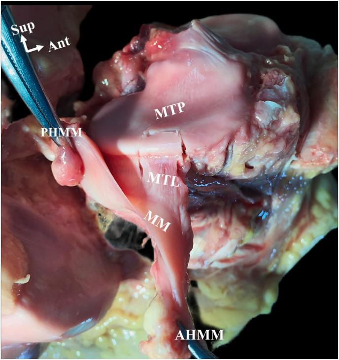 https://cdn.ncbi.nlm.nih.gov/pmc/blobs/5eda/11303972/818c45545883/gr4.jpg