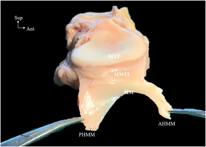 https://cdn.ncbi.nlm.nih.gov/pmc/blobs/5eda/11303972/eafc73a61847/gr2.jpg
