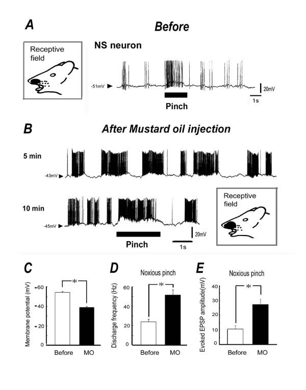 https://cdn.ncbi.nlm.nih.gov/pmc/blobs/5ee1/2891679/75082247b716/1744-8069-6-30-3.jpg