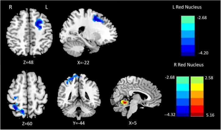 https://cdn.ncbi.nlm.nih.gov/pmc/blobs/5ee1/6849177/2460445a99b0/10194_2019_1058_Fig1_HTML.jpg