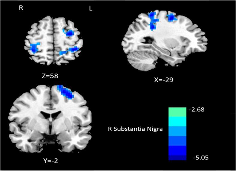 https://cdn.ncbi.nlm.nih.gov/pmc/blobs/5ee1/6849177/29dfb8983bf1/10194_2019_1058_Fig2_HTML.jpg