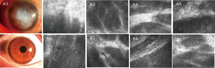 https://cdn.ncbi.nlm.nih.gov/pmc/blobs/5ee2/8114006/4fec5bf18491/iovs-62-6-12-f004d.jpg