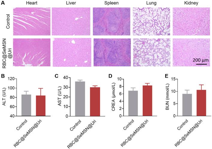 https://cdn.ncbi.nlm.nih.gov/pmc/blobs/5ee5/11746906/825d39fae3df/fbioe-12-1520663-g008.jpg