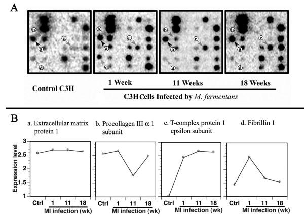 https://cdn.ncbi.nlm.nih.gov/pmc/blobs/5ee7/1559712/138b86873acb/1471-2407-6-116-2.jpg