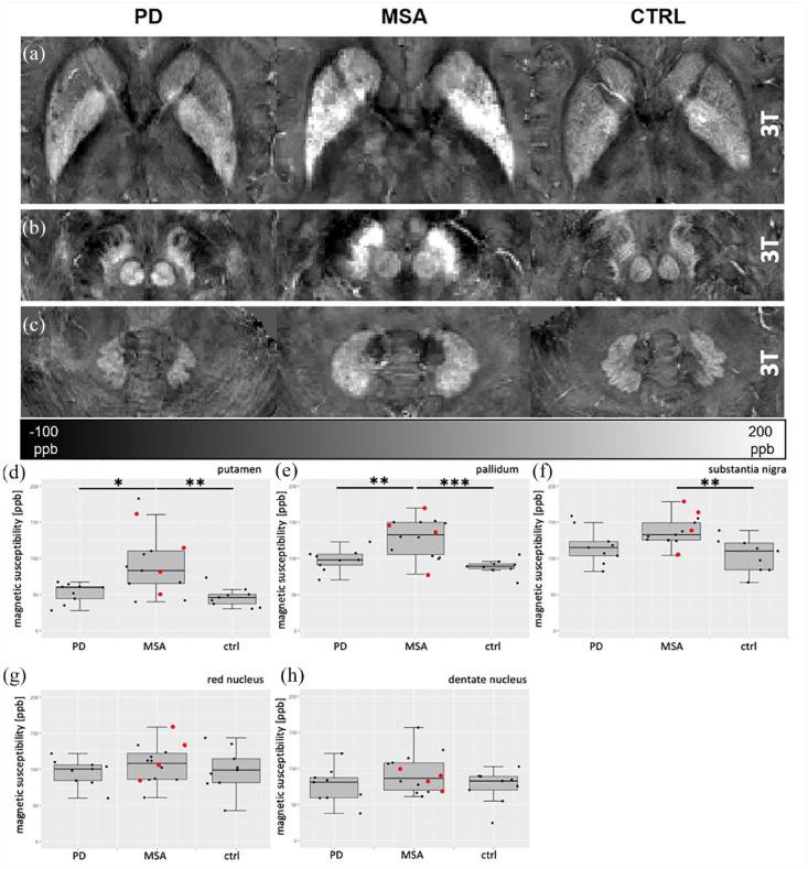 https://cdn.ncbi.nlm.nih.gov/pmc/blobs/5ee9/9950607/fd49ca3a3465/10.1177_17562864221143834-fig2.jpg