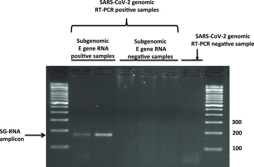 https://cdn.ncbi.nlm.nih.gov/pmc/blobs/5ef3/8111132/2a33cdc946c0/JCM.02277-20-f0001.jpg