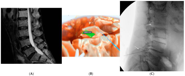 https://cdn.ncbi.nlm.nih.gov/pmc/blobs/5ef7/12072595/0aa305a9fd26/jcm-14-03019-g003.jpg