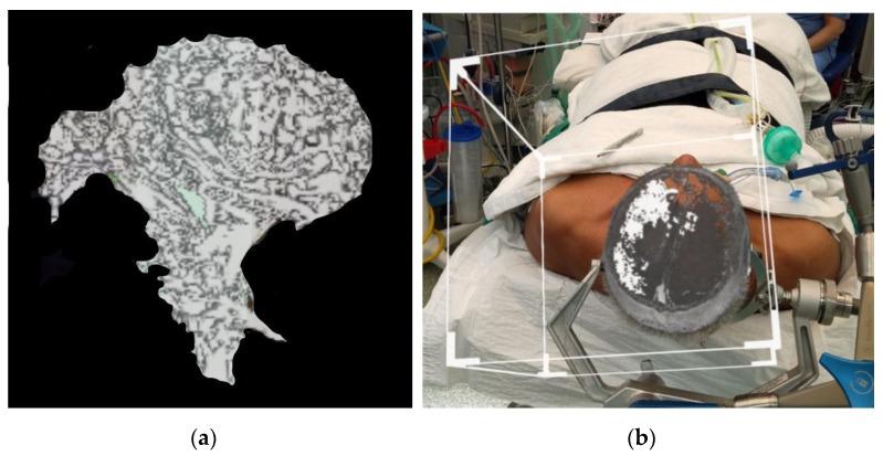 https://cdn.ncbi.nlm.nih.gov/pmc/blobs/5ef7/9965132/3397bcce3bca/life-13-00398-g008.jpg