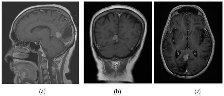 https://cdn.ncbi.nlm.nih.gov/pmc/blobs/5ef7/9965132/73810d3a197b/life-13-00398-g001.jpg