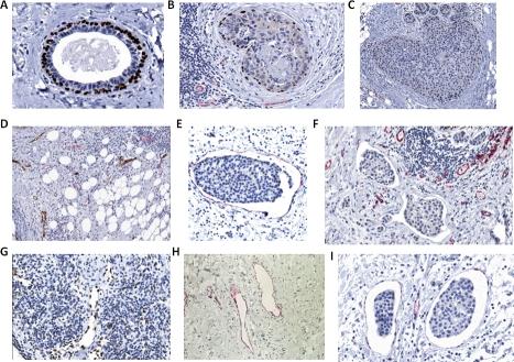 https://cdn.ncbi.nlm.nih.gov/pmc/blobs/5ef8/3157710/a75d8ee715ec/oncotarget-01-131-g009.jpg
