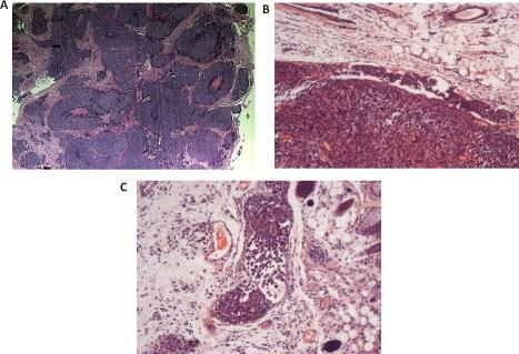 https://cdn.ncbi.nlm.nih.gov/pmc/blobs/5ef8/3157710/e065f31e94ff/oncotarget-01-131-g001.jpg