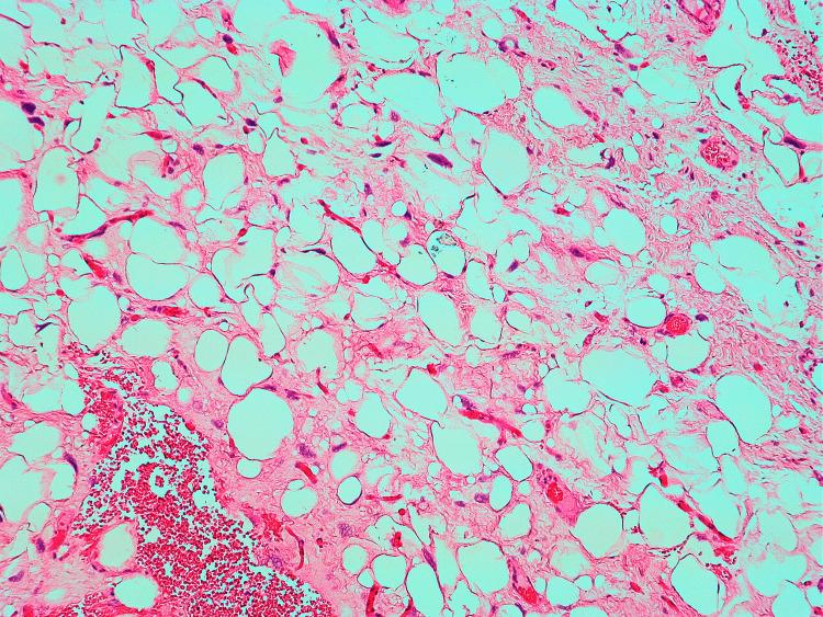 https://cdn.ncbi.nlm.nih.gov/pmc/blobs/5ef8/9536849/643242202550/cureus-0014-00000028856-i04.jpg