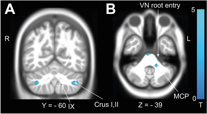 https://cdn.ncbi.nlm.nih.gov/pmc/blobs/5efc/10576698/47fb3cc73a49/415_2023_11859_Fig3_HTML.jpg